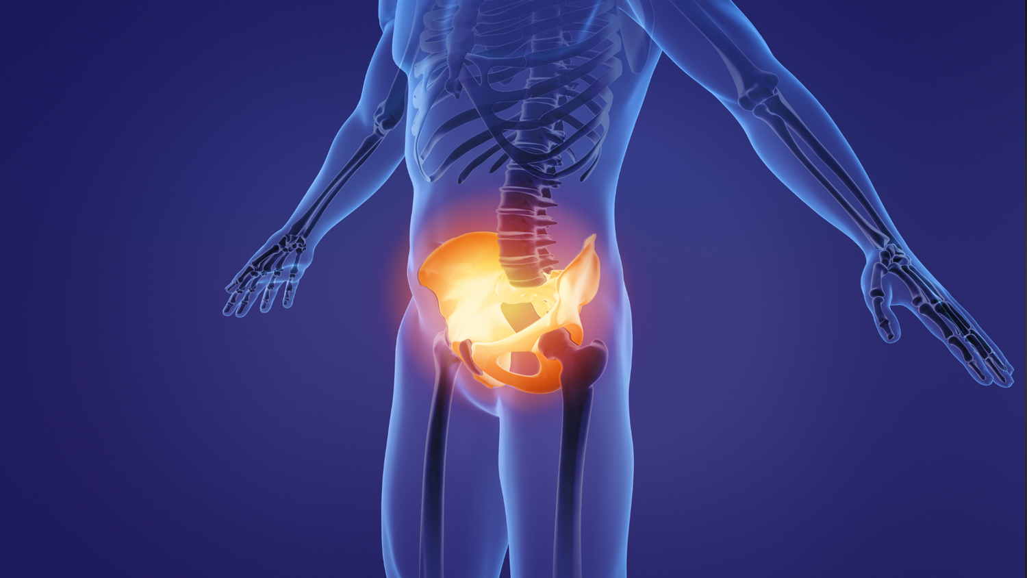 Highlighted pelvis showing anterior pelvic tilt in X-ray 
