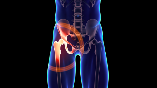 Anatomy of pelvis, hips, and thighs with hip socket highlighted