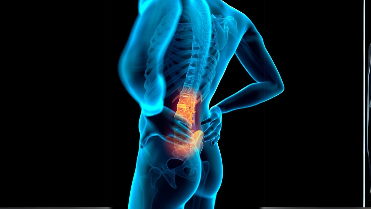 5 Best Exercises to Fix Lumbar Lordosis and Hyperextension – MoveU