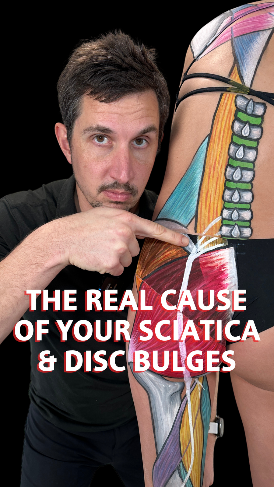 The Real Cause of Your Disc Herniation
